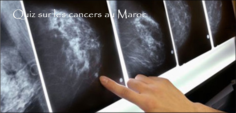 Quoi de neuf sur le cancer du sein au Maroc en 2017 ? : En 5 questions