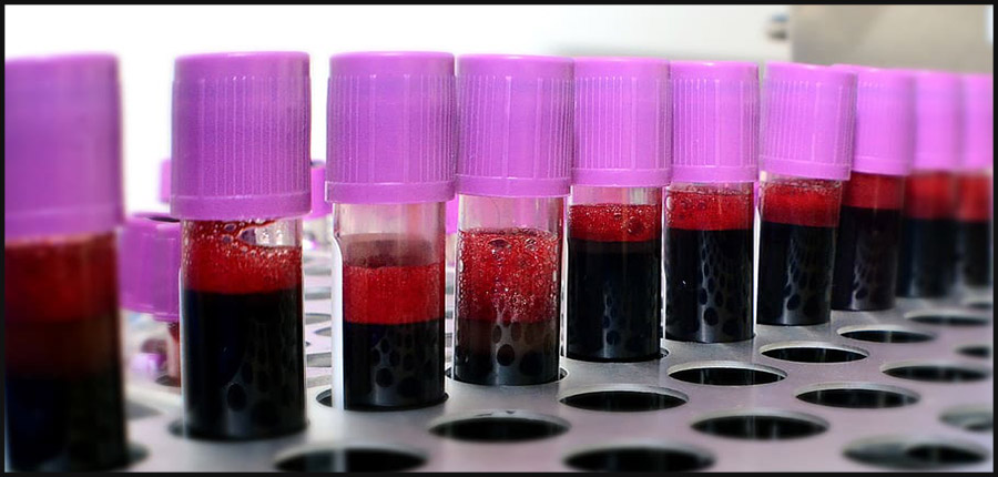 Histoires émouvantes du don de cellules sanguines entre frères et sœurs au Maroc