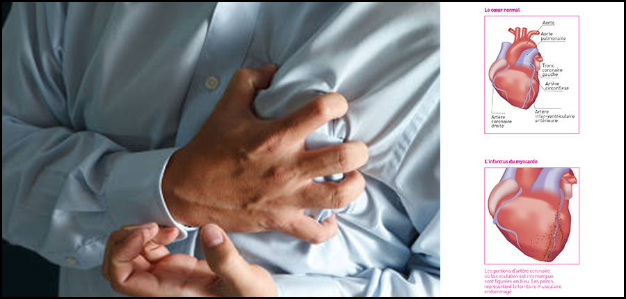 آخر المستجدات في علاج أمراض القلب بالمغرب / مراكش أيام 5 و 6 و7 أكتوبر 2017