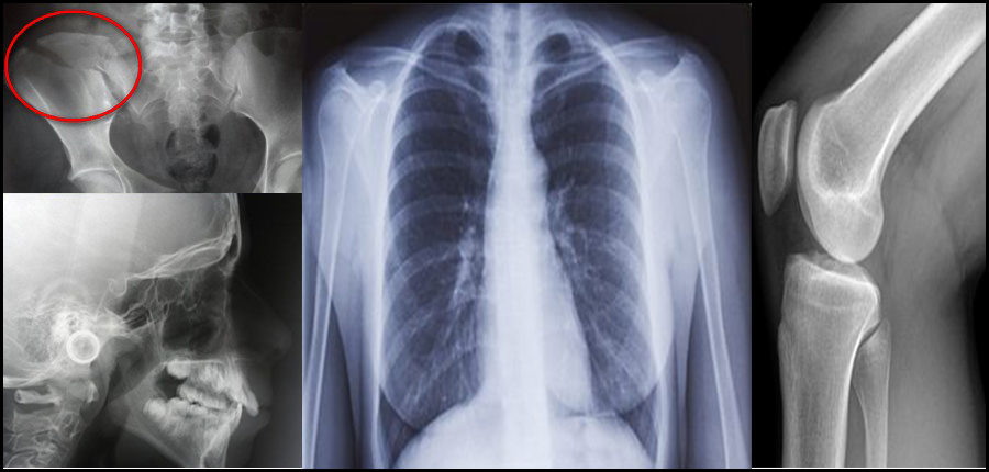 Quelles sont les possibilités techniques et réglementaires pour que l'imagerie médicale conventionnelle soit à la portée ?