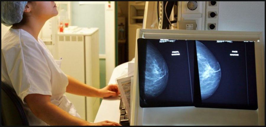 La tomosynthèse mammaire: pour un meilleur dépistage précoce des cancers du sein