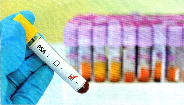 cancer prostate2015