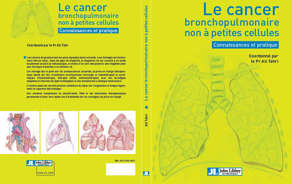 cancer poumon cigarette electro 001