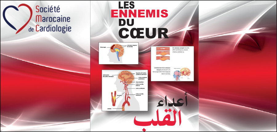 L'hémorragie au niveau du cerveau et l'obstruction de l'artère qui nourrit le cœur: C'est la paralysie du corps ou l’arrêt cardiaque